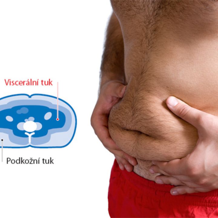 Visceral fat, why is it created and how to get rid of it?